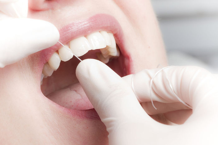 Behandlung mit Zahnseide